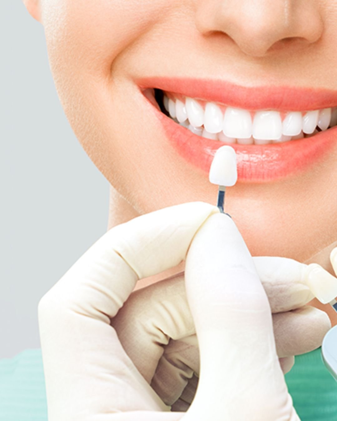 Cosmetic Dentistry treatment Langley