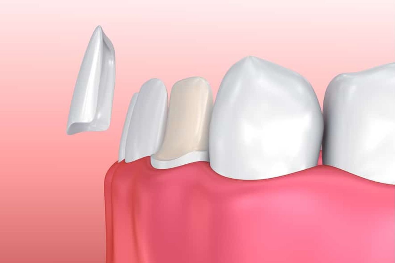 Cosmetic Langley
