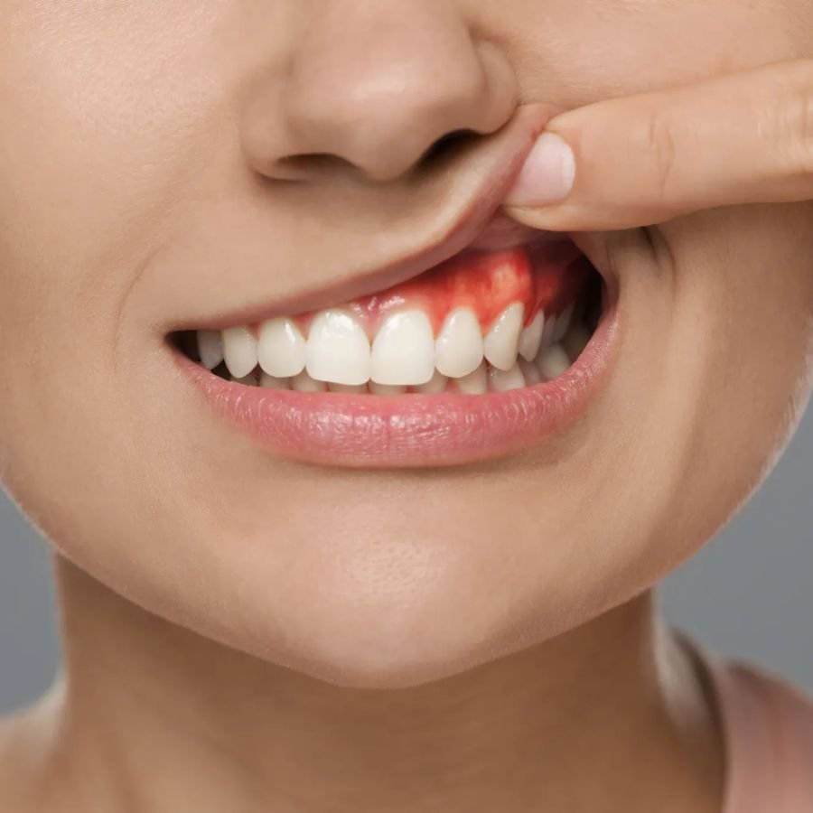 Dental Hygienist in Langley