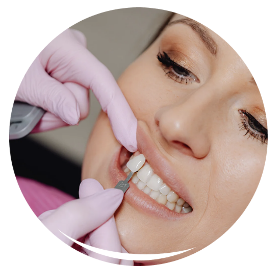 Dental Veneers Langley