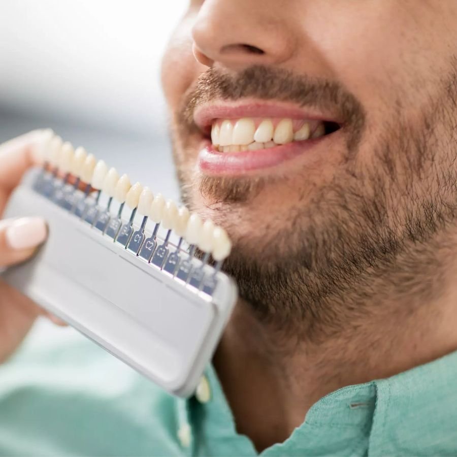 Dental Veneers