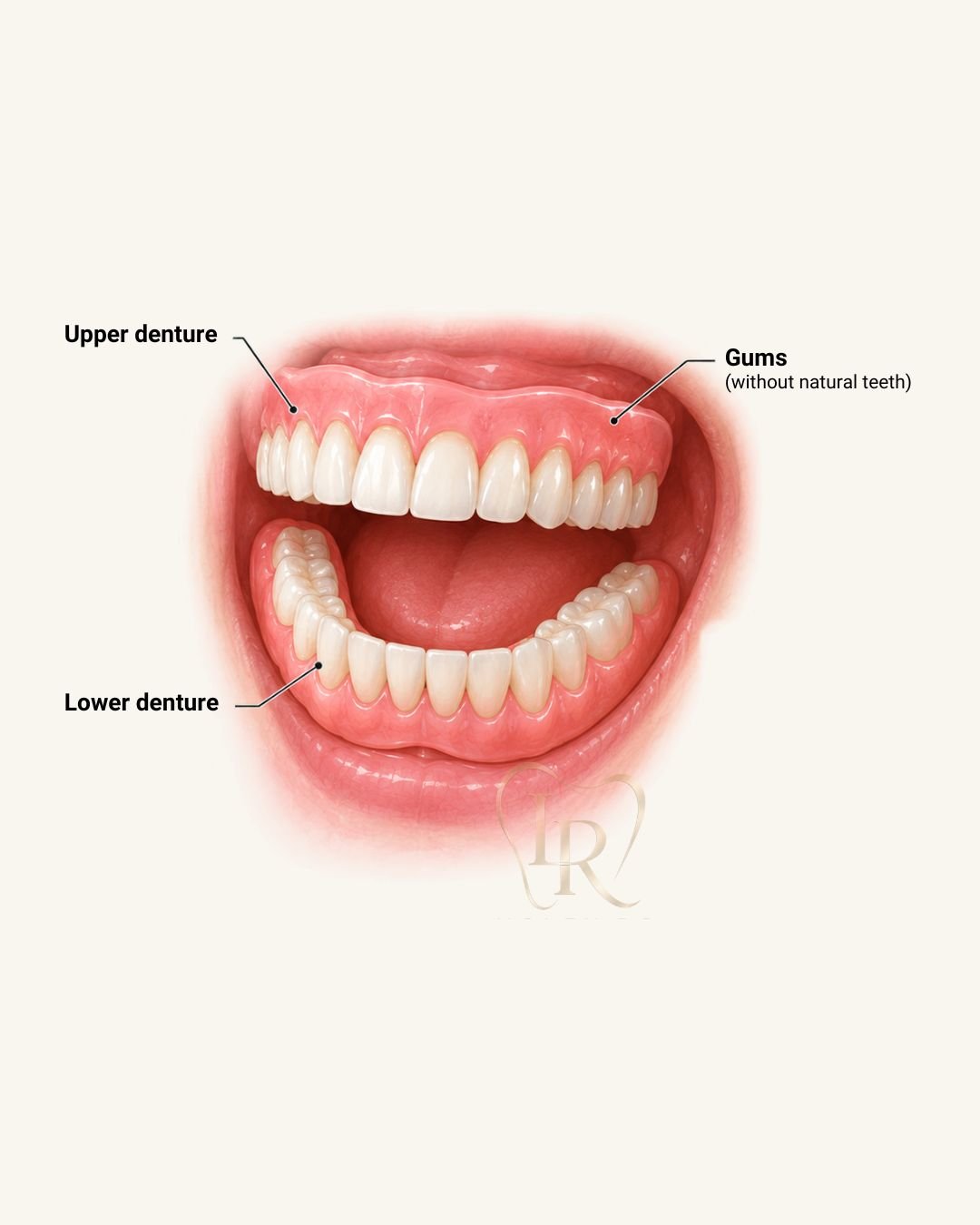 Dental dentures treatment Langley