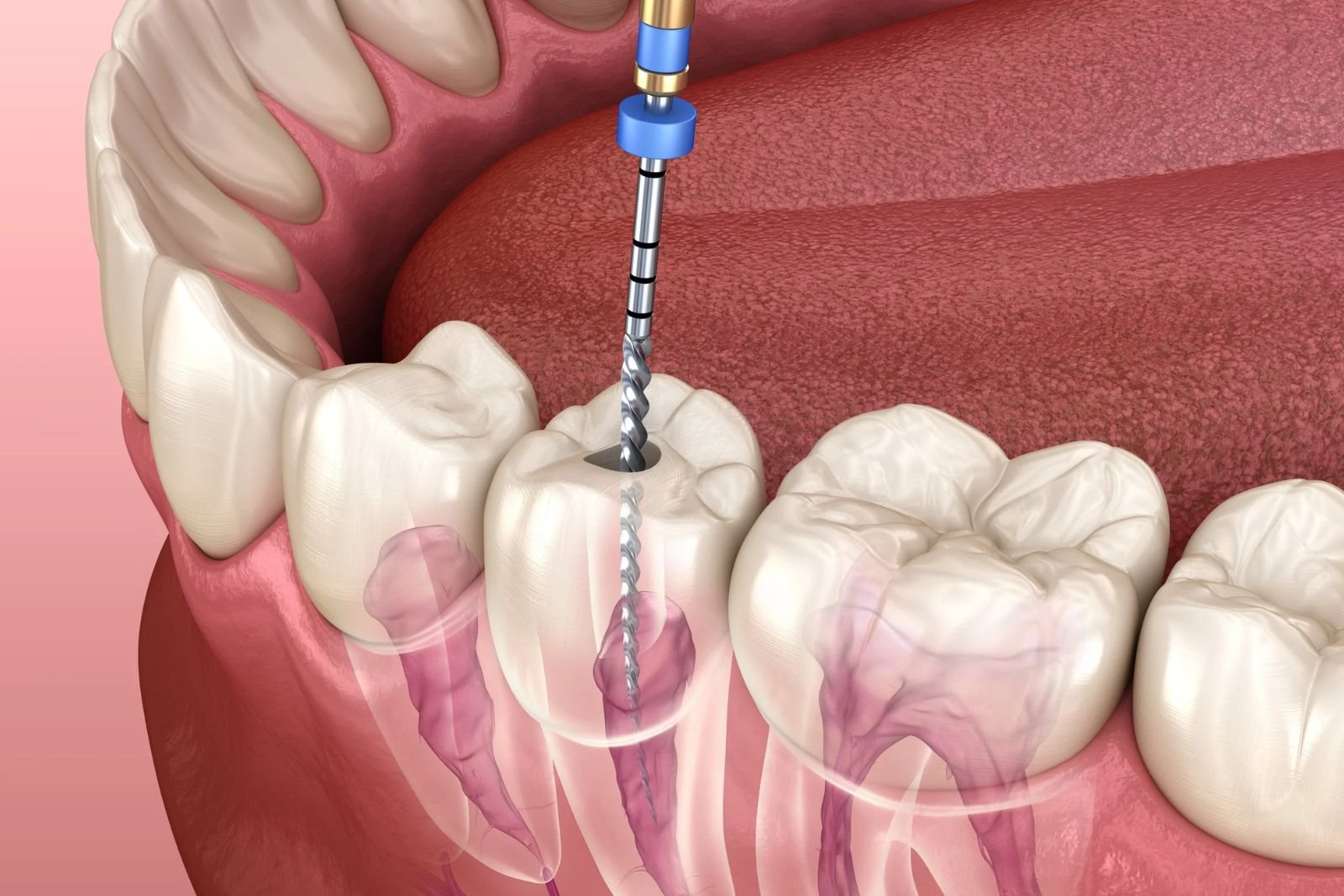 General dental Slough