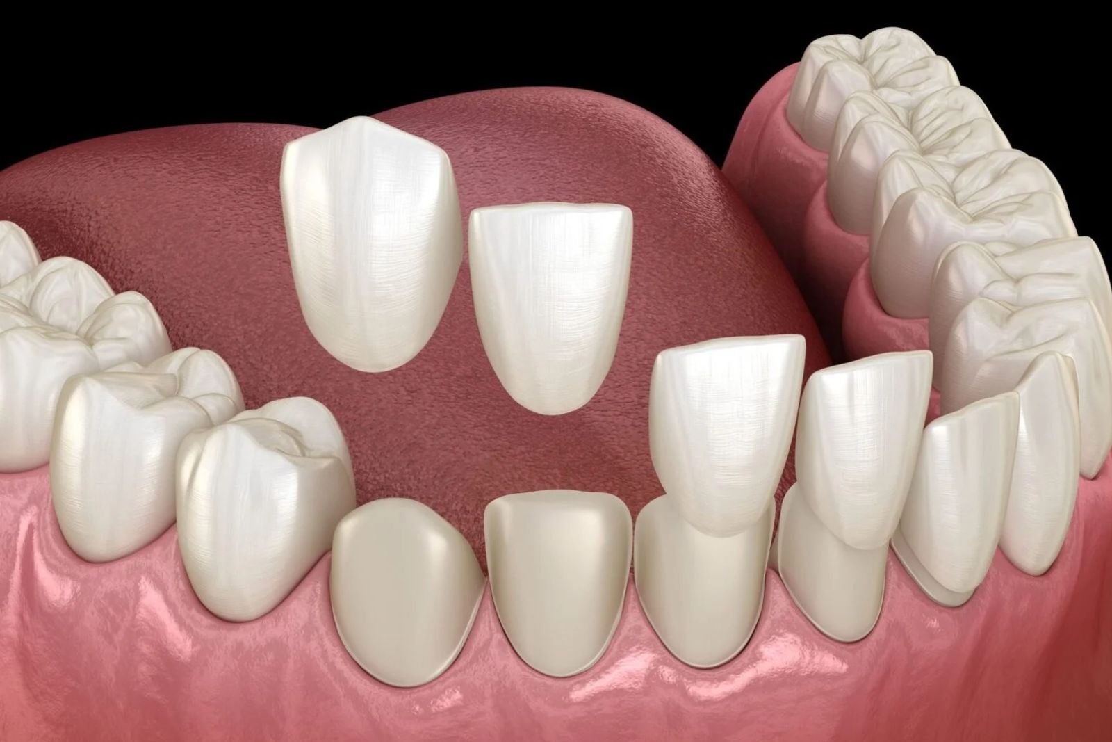 General dental in Slough