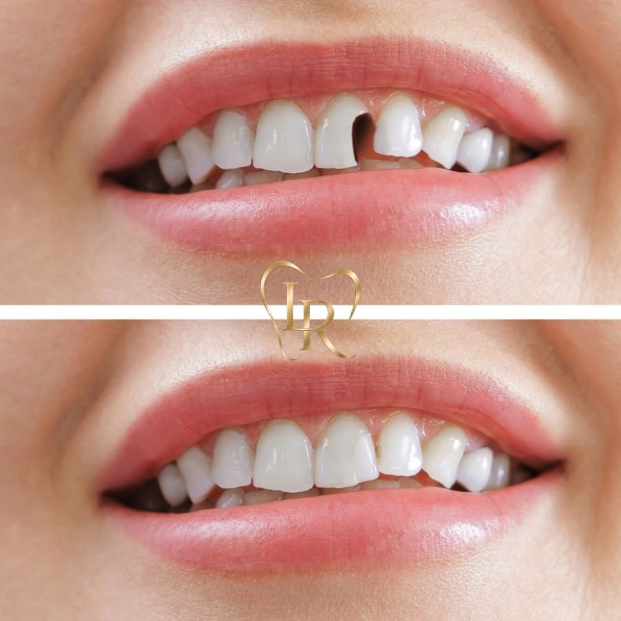 Langley Restorative Dental clinic