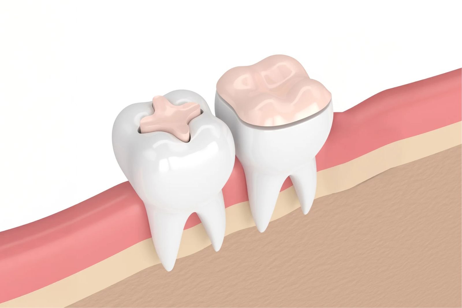 Langley Restorative Dentistry