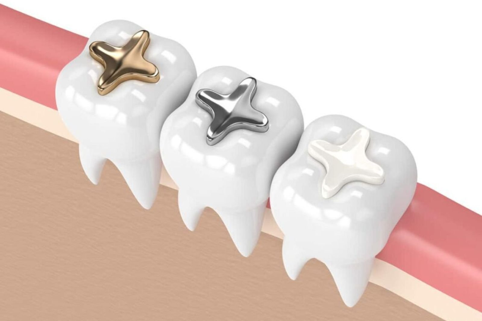 Restorative Dentistry in Slough