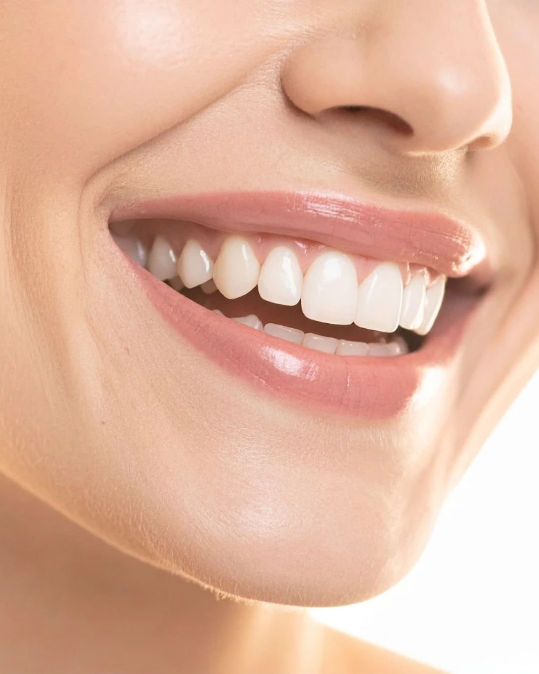 dental bridges dentist in Slough