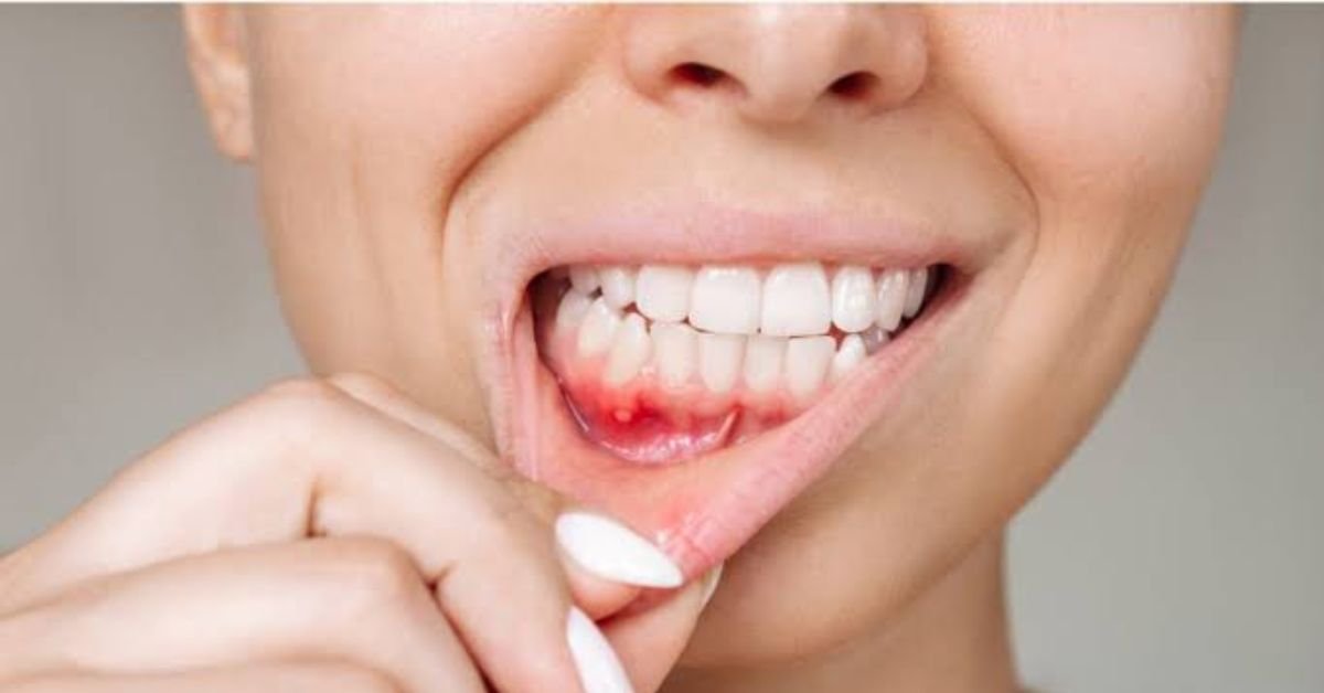 How to get rid of bad breath
